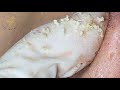 Satisfying Relaxing with Sac Dep Spa Video (#157)