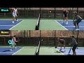 How To Block & Counter In Pickleball | Shut Down Hard-Hitter Attacks (& Fast Hands Tutorial)
