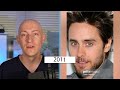 Jared Leto Mystery: Plastic Surgeon's Analysis of His Unchanging Face