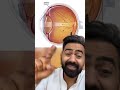 Doctor reacts to eye Floaters #shorts