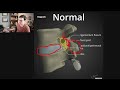 How I Read an MRI of the Lumbar Spine: Sequences, Search Pattern and Example Cases Explained