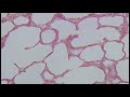 Identifying Epithelium | Review and Practice Questions