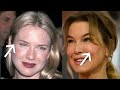 Renee Zellweger: Why She Looks So Different | Plastic Surgery Analysis