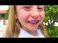 Nastya learns how important it is for children to wear braces
