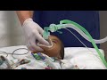 Paediatric Anaesthetics: Chapter 1 - Inhalational induction