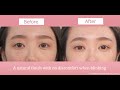 【Ledouble Official】Beautiful  Double Eyelid completion!!How to apply Single-line.