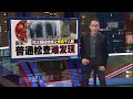 吃药仍不见病情好转   男子咳嗽两年多 以为患肺癌 | 新闻报报看 09/08/2024