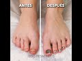 Cuidado de pies y trucos de pedicura que puedes repetir fácilmente en casa