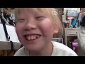 2万人に1人の難病“アルビノ”の少女‥色素が薄いだけでなく弱視との闘い「宿題も鬼ごっこも大変です」CBCドキュメンタリー