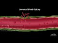 Hemostasis: Control of Bleeding, Coagulation and Thrombosis, Animation