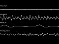 [OSCILOSCOPE] McKinley Dixon - Sun, I Rise