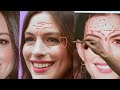 Truth Behind Anne Hathaway Look | Plastic Surgery Analysis