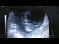 Baby Rivera - 11 weeks 6 days