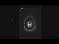 How to Read a Brain MRI: Basic Search Pattern & Sequences Explained